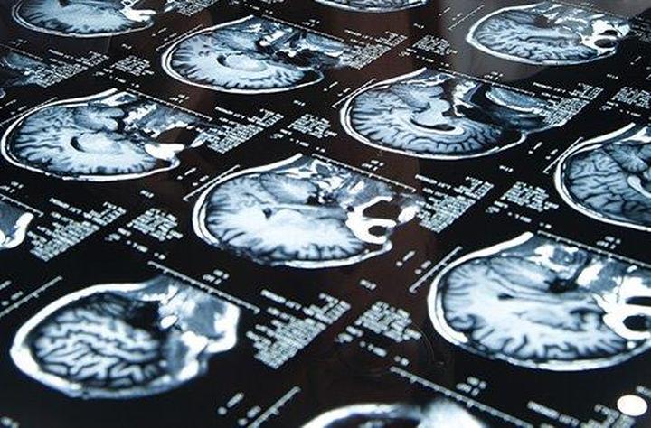 Naprawa błędów odtwarzania